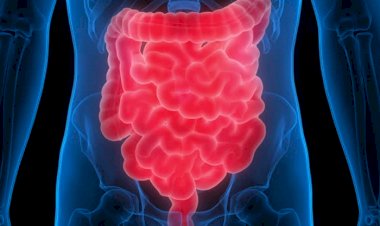 5 easy and natural ways to improve your digestion