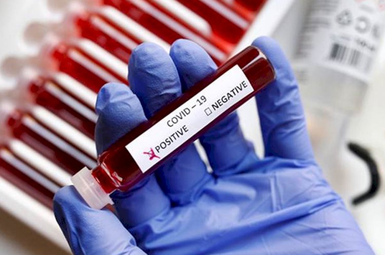 Ultimate Aim To Bring Down COVID Positivity Rate To 5%, Says Government